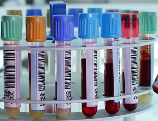 體外診斷IVD.png  體外診斷IVD.png